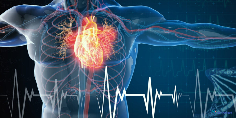 Атеросклеротическая болезнь сердца: причины и механизм развития, клинические проявления, принципы лечения